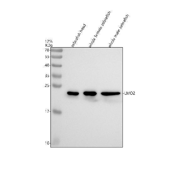  Western blot analysis of LMO2 using anti-LMO2 antibody (AZQ9PTJ3-1)