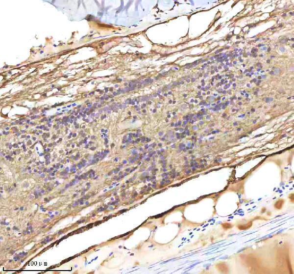  IHC analysis of LMO2 using anti-LMO2 antibody (AZQ9PTJ3)