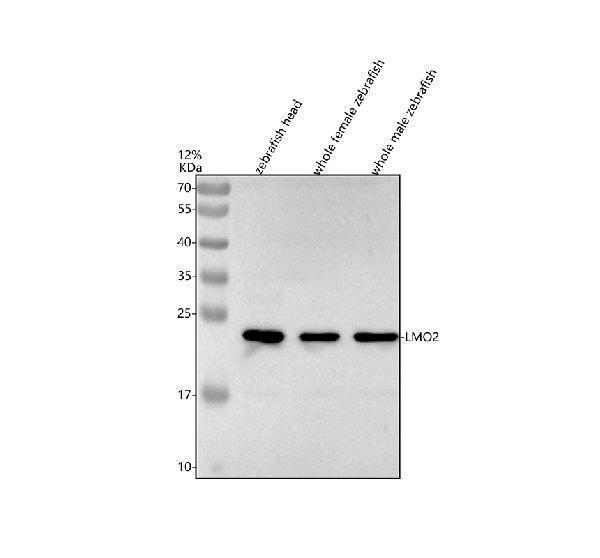  Western blot analysis of LMO2 using anti-LMO2 antibody (AZQ9PTJ3)