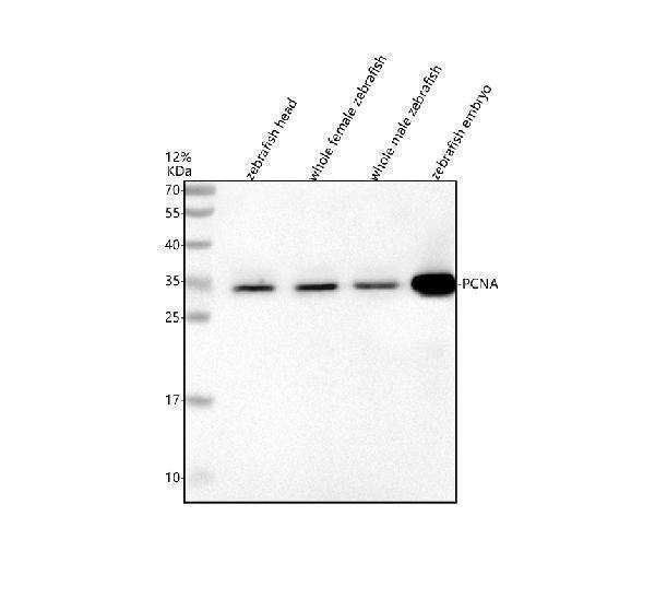  Western blot analysis of PCNA using anti-PCNA antibody (AZQ9PTP1)