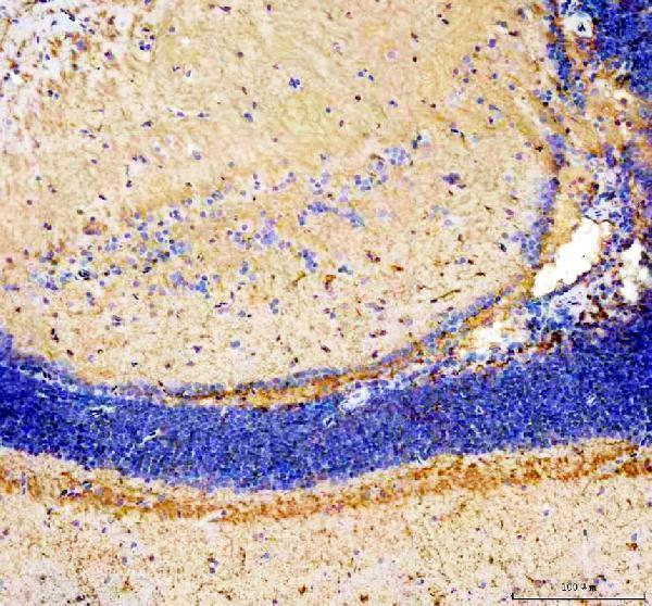 azq9pud0 igf2a primary antibodies ihc testing 2