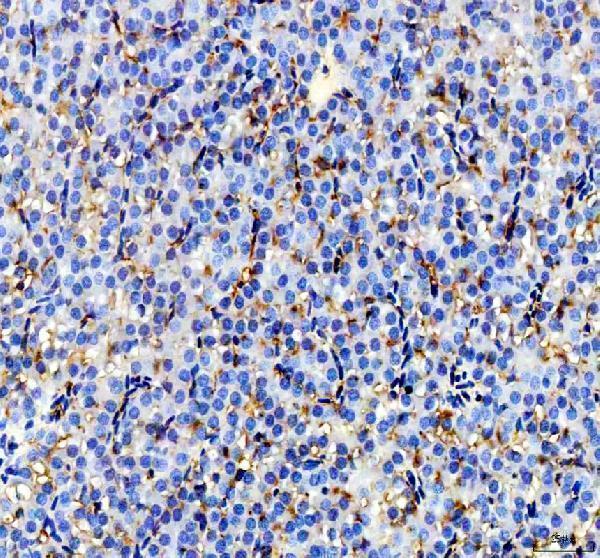 azq9pud0 igf2a primary antibodies ihc testing 3