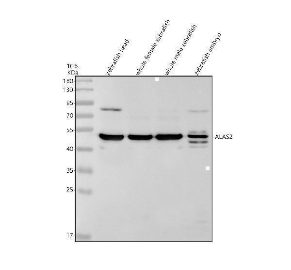 Western blot analysis of ALAS2 using anti-ALAS2 antibody (AZQ9YHT4)