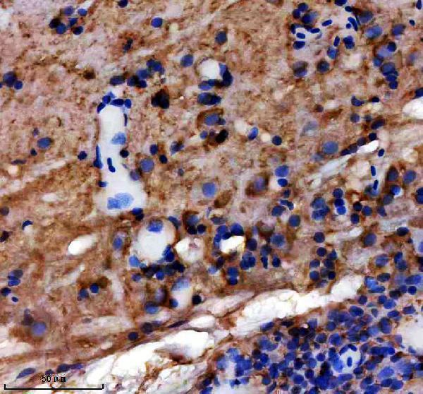 IHC analysis of Vimentin/VIM using anti-Vimentin/VIM antibody (AZQ9YHX5)