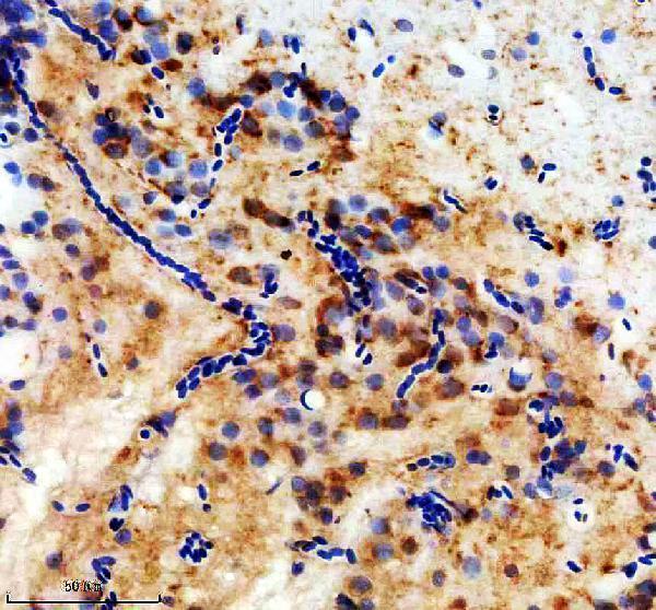 azq9yi00 fzd8a primary antibodies ihc testing 1