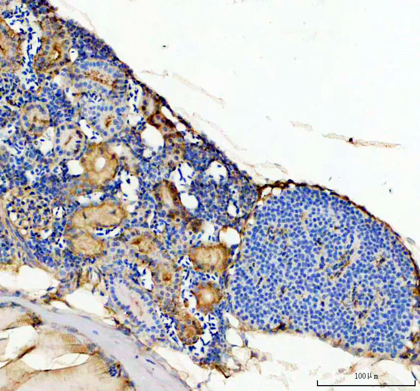 azx1wel2 gprc5ba primary antibodies ihc testing 2