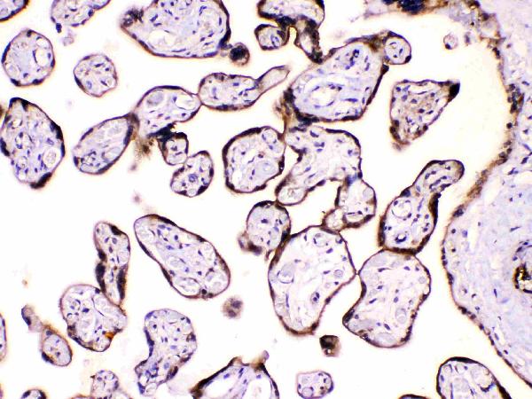 IHC analysis of Calpastatin using anti-Calpastatin antibody (A00337). Calpastatin was detected in paraffin-embedded section of human placenta tissues. Heat mediated antigen retrieval was performed in citrate buffer (pH6, epitope retrieval solution) for 20 mins. The tissue section was blocked with 10% goat serum. The tissue section was then incubated with 1μg/ml rabbit anti-Calpastatin Antibody (A00337) overnight at 4°C. Biotinylated goat anti-rabbit IgG was used as secondary antibody and incubated for 30 minutes at 37°C. The tissue section was developed using Strepavidin-Biotin-Complex (SABC)(Catalog # SA1022) with DAB as the chromogen.