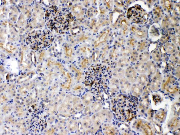 a00410 3 IHC anti dr5 picoband antibody