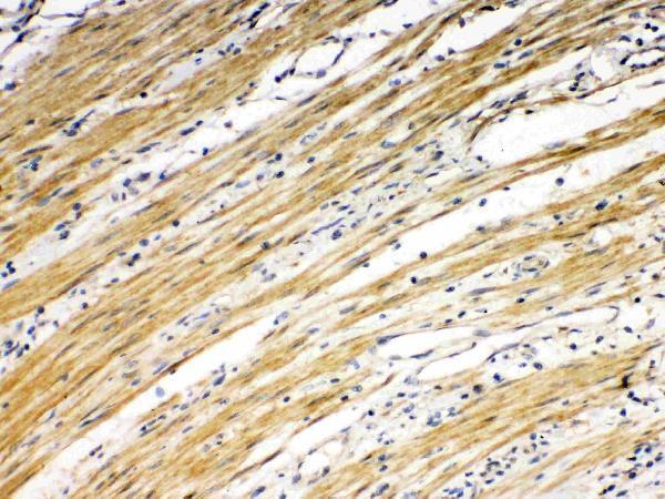 a00410 4 IHC anti dr5 picoband antibody