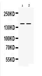  Western blot analysis of nNOS using anti-nNOS antibody (A01070)