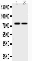 Figure 1. Western blot analysis of GAB1 using anti-GAB1 antibody (A01989-1). Electrophoresis was performed on a 5-20% SDS-PAGE gel at 70V (Stacking gel) / 90V (Resolving gel) for 2-3 hours. The sample well of each lane was loaded with 50ug of sample under reducing conditions. lane 1: rat testis tissue lysates, lane 2: K562 whole cell lysates. After Electrophoresis, proteins were transferred to a Nitrocellulose membrane at 150mA for 50-90 minutes. Blocked the membrane with 5% Non-fat Milk/ TBS for 1.5 hour at RT. The membrane was incubated with rabbit anti-GAB1 antigen affinity purified polyclonal antibody (Catalog # A01989-1) at 0.5 microg/mL overnight at 4°C, then washed with TBS-0.1%Tween 3 times with 5 minutes each and probed with a goat anti-rabbit IgG-HRP secondary antibody at a dilution of 1:10000 for 1.5 hour at RT. The signal is developed using an Enhanced Chemiluminescent detection (ECL) kit (Catalog # EK1002) with Tanon 5200 system. A specific band was detected for GAB1 at approximately 77KD. The expected band size for GAB1 is at 77KD.