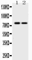Western blot analysis of GAB1 using anti-GAB1 antibody (A01989-1).