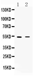 Western blot analysis of CHRNA5 using anti-CHRNA5 antibody (A02359-2). Electrophoresis was performed on a 5-20% SDS-PAGE gel at 70V (Stacking gel) / 90V (Resolving gel) for 2-3 hours. The sample well of each lane was loaded with 50ug of sample under reducing conditions. lane 1: rat skeletal muscle tissue lysates, lane 2: HEPG2 whole cell lysates. After Electrophoresis, proteins were transferred to a Nitrocellulose membrane at 150mA for 50-90 minutes. Blocked the membrane with 5% Non-fat Milk/ TBS for 1.5 hour at RT. The membrane was incubated with rabbit anti-CHRNA5 antigen affinity purified polyclonal antibody (Catalog # A02359-2) at 0.5 μg/mL overnight at 4°C, then washed with TBS-0.1%Tween 3 times with 5 minutes each and probed with a goat anti-rabbit IgG-HRP secondary antibody at a dilution of 1:10000 for 1.5 hour at RT. The signal is developed using an Enhanced Chemiluminescent detection (ECL) kit (Catalog # EK1002) with Tanon 5200 system. A specific band was detected for CHRNA5 at approximately 53KD. The expected band size for CHRNA5 is at 53KD.