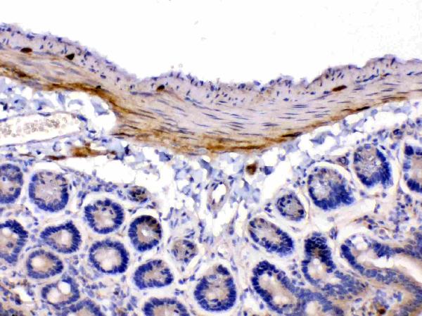 IHC analysis of CHRNA5 using anti-CHRNA5 antibody (A02359-2). CHRNA5 was detected in paraffin-embedded section of mouse intestine tissues. Heat mediated antigen retrieval was performed in citrate buffer (pH6, epitope retrieval solution) for 20 mins. The tissue section was blocked with 10% goat serum. The tissue section was then incubated with 1μg/ml rabbit anti-FBXL4 Antibody (A02359-2) overnight at 4°C. Biotinylated goat anti-rabbit IgG was used as secondary antibody and incubated for 30 minutes at 37°C. The tissue section was developed using Strepavidin-Biotin-Complex (SABC)(Catalog # SA1022) with DAB as the chromogen.