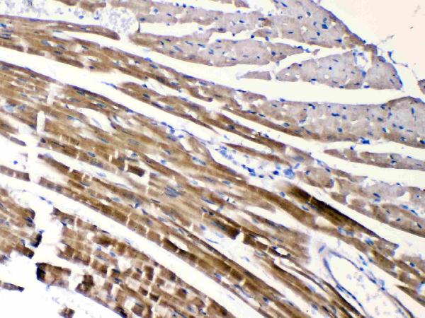 IHC analysis of CHRNA5 using anti-CHRNA5 antibody (A02359-2). CHRNA5 was detected in paraffin-embedded section of mouse cardiac muscle tissues. Heat mediated antigen retrieval was performed in citrate buffer (pH6, epitope retrieval solution) for 20 mins. The tissue section was blocked with 10% goat serum. The tissue section was then incubated with 1μg/ml rabbit anti-CHRNA5 Antibody (A02359-2) overnight at 4°C. Biotinylated goat anti-rabbit IgG was used as secondary antibody and incubated for 30 minutes at 37°C. The tissue section was developed using Strepavidin-Biotin-Complex (SABC)(Catalog # SA1022) with DAB as the chromogen.