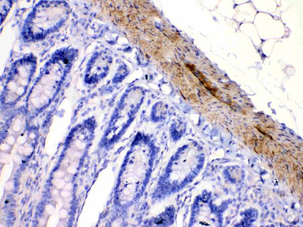 IHC analysis of CHRNA5 using anti-CHRNA5 antibody (A02359-2). CHRNA5 was detected in paraffin-embedded section of rat intestine tissues. Heat mediated antigen retrieval was performed in citrate buffer (pH6, epitope retrieval solution) for 20 mins. The tissue section was blocked with 10% goat serum. The tissue section was then incubated with 1μg/ml rabbit anti-CHRNA5 Antibody (A02359-2) overnight at 4°C. Biotinylated goat anti-rabbit IgG was used as secondary antibody and incubated for 30 minutes at 37°C. The tissue section was developed using Strepavidin-Biotin-Complex (SABC)(Catalog # SA1022) with DAB as the chromogen.