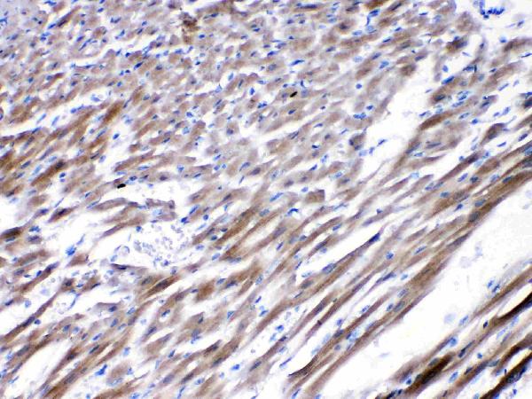 IHC analysis of CHRNA5 using anti-CHRNA5 antibody (A02359-2). CHRNA5 was detected in paraffin-embedded section of rat cardiac muscle tissues. Heat mediated antigen retrieval was performed in citrate buffer (pH6, epitope retrieval solution) for 20 mins. The tissue section was blocked with 10% goat serum. The tissue section was then incubated with 1μg/ml rabbit anti-FBXL4 Antibody (A02359-2) overnight at 4°C. Biotinylated goat anti-rabbit IgG was used as secondary antibody and incubated for 30 minutes at 37°C. The tissue section was developed using Strepavidin-Biotin-Complex (SABC)(Catalog # SA1022) with DAB as the chromogen.