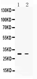 Figure 1. Western blot analysis of TSG6 using anti-TSG6 antibody (A03433-1). Electrophoresis was performed on a 5-20% SDS-PAGE gel at 70V (Stacking gel) / 90V (Resolving gel) for 2-3 hours. The sample well of each lane was loaded with 30 ug of sample under reducing conditions. Lane 1: rat brain tissue lysates, Lane 2: human Hela whole cell lysates. After electrophoresis, proteins were transferred to a nitrocellulose membrane at 150 mA for 50-90 minutes. Blocked the membrane with 5% non-fat milk/TBS for 1.5 hour at RT. The membrane was incubated with rabbit anti-TSG6 antigen affinity purified polyclonal antibody (Catalog # A03433-1) at 0.5 microg/mL overnight at 4°C, then washed with TBS-0.1%Tween 3 times with 5 minutes each and probed with a goat anti-rabbit IgG-HRP secondary antibody at a dilution of 1:5000 for 1.5 hour at RT. The signal is developed using an Enhanced Chemiluminescent detection (ECL) kit (Catalog # EK1002) with Tanon 5200 system. A specific band was detected for TSG6 at approximately 31 kDa. A specific band was detected for TSG6 at approximately 31 kDa.