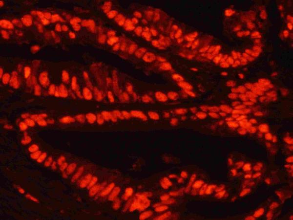 ba1090 2 IHC goat anti rabbit igg secondary antibody tritc conjugate