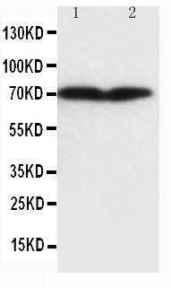 Anti-Collagen, Type III antibody (monoclonal), MA1029, Western blotting Lane 1: HT1080 Cell Lysate Lane 2: COLO320 Cell Lysate