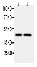 Anti-Caspase-2 antibody, PA1113, Western blotting Lane 1: CEM Cell Lysate Lane 2: SMMC Cell Lysate