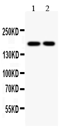 Anti-Topoisomerase II alpha antibody, PA1127, Western blotting All lanes: Anti Topoisomerase II alpha (PA1127) at 0.5ug/ml Lane 1: HELA Whole Cell Lysate at 40ug Lane 2: JURKAT Whole Cell Lysate at 40ug Predicted bind size: 174KD Observed bind size: 174KD
