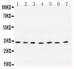  Western blot analysis of Cyclin D1 using anti-Cyclin D1 antibody (PA1245-2)