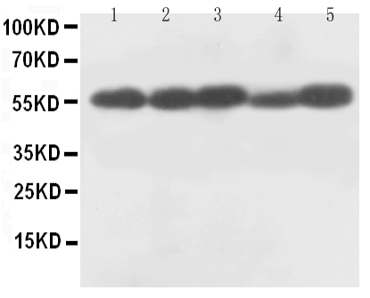Anti-Caspase-8(P18) antibody, PA1308, Western blotting All lanes: Anti Caspase-8(P18) (PA1308) at 0.5ug/ml Lane 1: Rat Thymus Tissue Lysate at 50ug Lane 2: Rat Liver Tissue Lysate at 50ug Lane 3: MCF-7 Whole Cell Lysate at 40ug Lane 4: HELA Whole Cell Lysate at 40ug Lane 5: SMMC Whole Cell Lysate at 40ug Predicted bind size: 55KD Observed bind size: 55KD