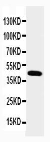 Western blot analysis of NPHS2 using anti-NPHS2 antibody (PA1322-1). Electrophoresis was performed on a 5-20% SDS-PAGE gel at 70V (Stacking gel) / 90V (Resolving gel) for 2-3 hours. The sample well of each lane was loaded with 50ug of sample under reducing conditions. Lane 1: rat kidney tissue lysate. After Electrophoresis, proteins were transferred to a Nitrocellulose membrane at 150mA for 50-90 minutes. Blocked the membrane with 5% Non-fat Milk/ TBS for 1.5 hour at RT. The membrane was incubated with rabbit anti-NPHS2 antigen affinity purified polyclonal antibody (Catalog # PA1322-1) at 0.5 μg/mL overnight at 4°C, then washed with TBS-0.1%Tween 3 times with 5 minutes each and probed with a goat anti-rabbit IgG-HRP secondary antibody at a dilution of 1:10000 for 1.5 hour at RT. The signal is developed using an Enhanced Chemiluminescent detection (ECL) kit (Catalog # EK1002) with Tanon 5200 system. A specific band was detected for NPHS2 at approximately 45KD. The expected band size for NPHS2 is at 42KD.