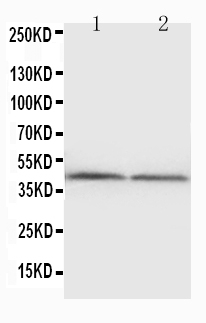 Anti-NPHS2 antibody, PA1322, Western blotting WB: Rat Kidney Tissue Lysate