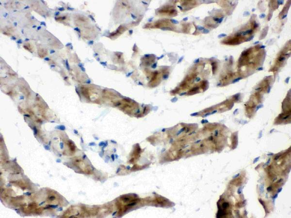 Cardiac FABP was detected in paraffin-embedded sections of rat cardiac muscle tissues using rabbit anti-Cardiac FABP Antigen Affinity purified polyclonal antibody (Catalog # PA1336) at 1 μg/mL