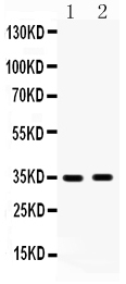 Anti-HSD17B6 antibody, PA1386, Western blotting All lanes: Anti HSD17B6 (PA1386) at 0.5ug/ml Lane 1: Human Placenta Tissue Lysate at 50ug Lane 2: MCF-7 Whole Cell Lysate at 40ug Predicted bind size: 35KD Observed bind size: 35KD