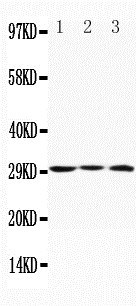 Anti-Apolipoprotein D antibody, PA1388, Western blottingLane 1: MCF-7 Cell LysateLane 2: HELA Cell LysateLane 3: SMMC Cell Lysate