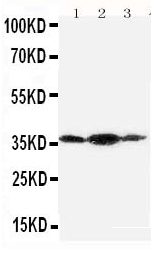 Anti-Podoplanin/gp36 antibody, PA1411, Western blottingAll lanes: Anti Podoplanin/gp36 (PA1411) at 0