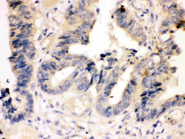 pa1442 2 IHC anti caspase 7 p11 antibody