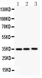 Anti-GM-CSF antibody, PA1456, Western blotting All lanes: Anti GM-CSF (PA1456) at 0.5ug/ml Lane 1: JURKAT Whole Cell Lysate at 40ug Lane 2: HELA Whole Cell Lysate at 40ug Lane 3: HT1080Whole Cell Lysate at 40ug Predicted bind size: 16KD Observed bind size: 35KD