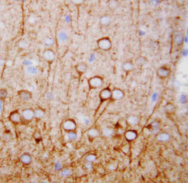 pa1520 2 IHC anti camkk antibody