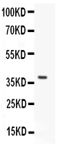Anti-Stra8 antibody, PA1528, Western blotting All lanes: Anti Stra8(PA1528) at 0.5ug/ml WB : Rat Testis Tissue Lysate at 50ug Predicted bind size: 37KD Observed bind size: 37KD