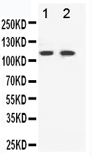 pa1569 1 WB anti eph receptor b3 antibody