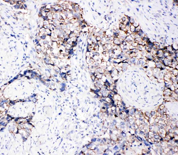 pa1569 2 IHC anti eph receptor b3 antibody