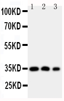 Anti-HOXA4 antibody, PA1603, Western blotting Lane 1: SW620 Cell Lysate Lane 2: SW620 Cell Lysate Lane 3: PC-12 Cell Nuclear Lysate