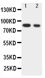 Anti-IKK alpha antibody, PA1614, Western blotting Lane 1: HELA Cell Lysate Lane 2: JURKAT Cell Lysate
