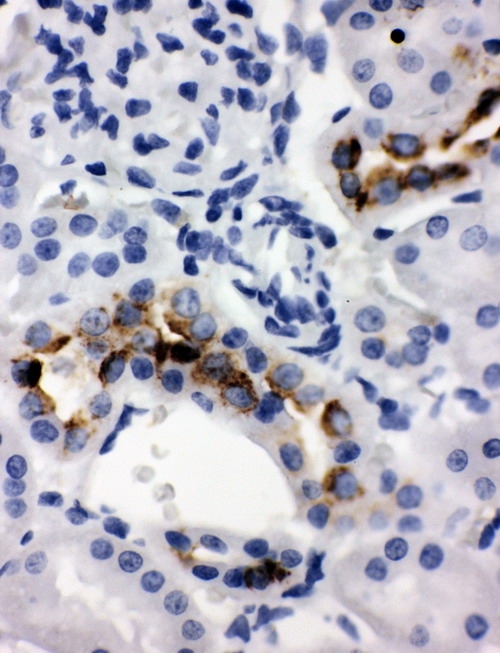 pa1633 2 IHC anti klk1 kallikrein 1 antibody