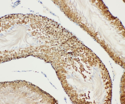 pa1645 2 IHC anti bub3 antibody