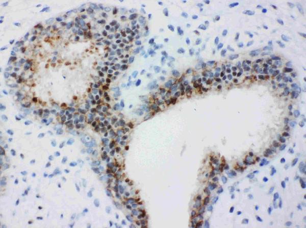 pa1645 3 IHC anti bub3 antibody