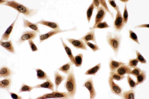 pa1645 5 IF anti bub3 antibody