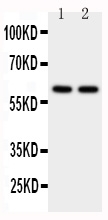 pa1698 1 WB anti cyp11a1 antibody