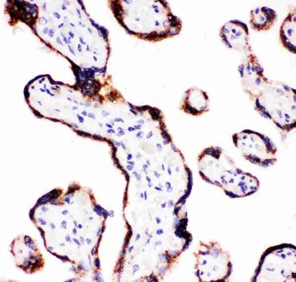 pa1698 2 IHC anti cyp11a1 antibody
