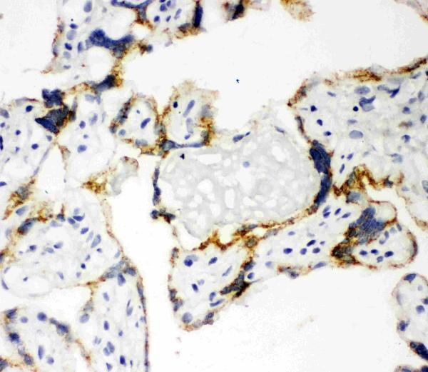 pa1698 3 IHC anti cyp11a1 antibody