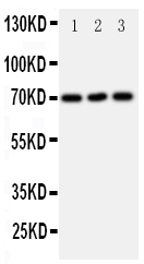Anti-SLC6A4 antibody, PA1705, Western blottingAll lanes: Anti SLC6A4 (PA1705) at 0